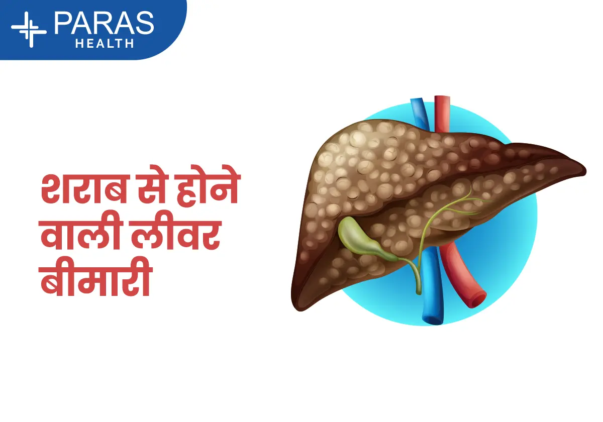 sharab ka liver par asar